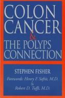 Colon cancer & the polyps connection by Stephen J. Fisher