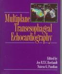 Cover of: Multiplane transesophageal echocardiography