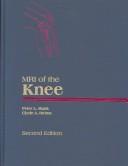 Cover of: MRI of the knee