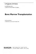 Cover of: Bone marrow transplantation
