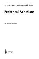 Cover of: Peritoneal adhesions by K.-H. Treutner, V. Schumpelick (Eds.).