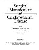 Surgical management of cerebrovascular disease by R. Eugene Zierler