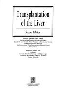 Cover of: Transplantation of the liver