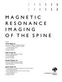 Magnetic resonance imaging of the spine by Val M. Runge