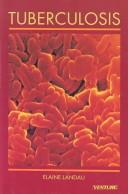 Cover of: Tuberculosis by Elaine Landau