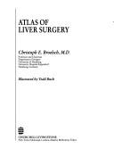 Atlas of liver surgery by Christoph E. Broelsch