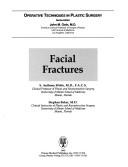 Cover of: Facial fractures by S. Anthony Wolfe, S. Anthony Wolfe