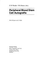 Peripheral blood stem cell autografts