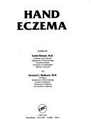 Cover of: Hand eczema