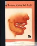 Cover of: Why replace a missing back tooth? by Joel M. Berns
