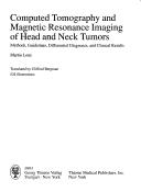 Cover of: Computed tomography and magnetic resonance imaging of head and neck tumors: methods, guidelines, differential diagnoses, and clinical results