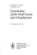Cover of: Carcinoma of the oral cavity and oropharynx | 