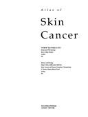 Cover of: Atlas of skin cancer