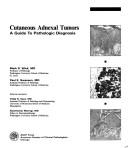 Cover of: Cutaneous adnexal tumors by Mark R. Wick