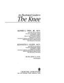 Cover of: An illustrated guide to the knee