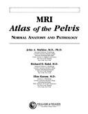 Cover of: MRI atlas of the pelvis: normal anatomy and pathology