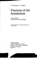 Cover of: Fractures of the acetabulum by Émile Letournel