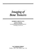 Cover of: Imaging of bone tumors by Morrie E. Kricun