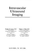 Intravascular ultrasound imaging by Douglas M. Cavaye