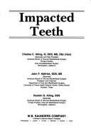 Cover of: Impacted teeth by [edited by] Charles C. Alling III, John F. Helfrick, Rocklin D. Alling.