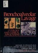 Cover of: Bronchoalveolar lavage by Michael W. Stanley