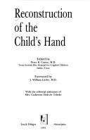 Cover of: Reconstruction of the child's hand