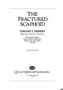 The fractured scaphoid by Timothy J. Herbert