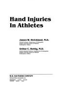 Cover of: Hand injuries in athletes