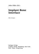 Implant bone interface