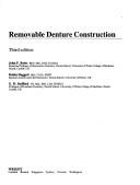 Cover of: Removable denture construction