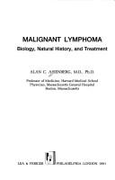 Malignant lymphoma by Alan C. Aisenberg