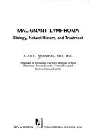 Cover of: Malignant lymphoma by Alan C. Aisenberg