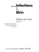 Cover of: Atlas of infections of the skin by Anthony Du Vivier