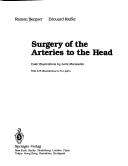 Cover of: Surgery of the  arteries to the head by Ramon Berguer