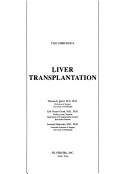 Cover of: Liver transplantation