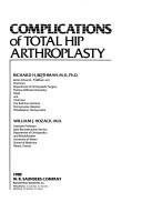 Cover of: Complications of total hip arthroplasty