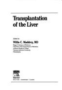 Cover of: Transplantation of the liver