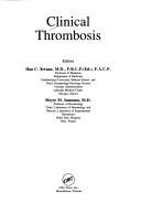 Cover of: Clinical thrombosis