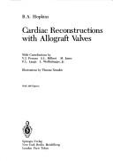 Cardiac reconstructions with allograft valves by R. A. Hopkins