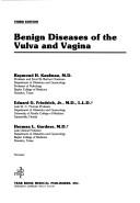 Cover of: Benign diseases of the vulva and vagina by Raymond H. Kaufman, Raymond H. Kaufman