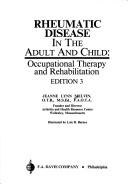 Rheumatic disease in the adult and child by Jeanne L. Melvin