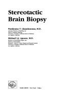 Cover of: Stereotactic brain biopsy