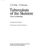 Cover of: Tuberculosis of the skeleton by Cornelis Jacob Pieter Thijn