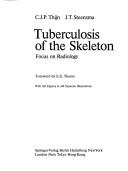 Cover of: Tuberculosis of the skeleton: focus on radiology