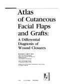 Cover of: Atlas of cutaneous facial flaps and grafts: a differential diagnosis of wound closures