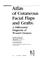 Cover of: Atlas of cutaneous facial flaps and grafts