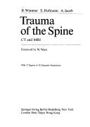 Trauma of the spine by B. Wimmer