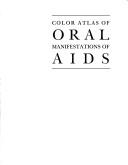 Color atlas of oral manifestations of AIDS by Sol Silverman