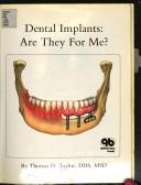 Dental implants by Thomas D. Taylor