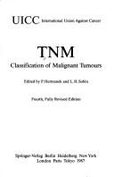Cover of: TNM classification of malignant tumours